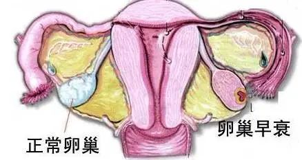 明明才20多岁，为什么就“卵巢早衰”了呢？